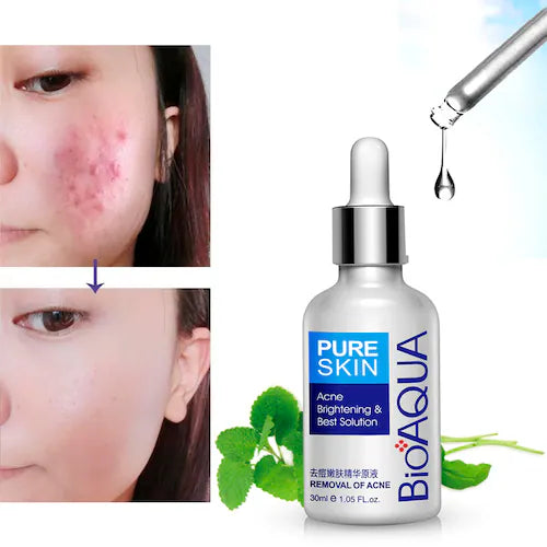 SERUM FACIAL ANTIACNE BIOAQUA